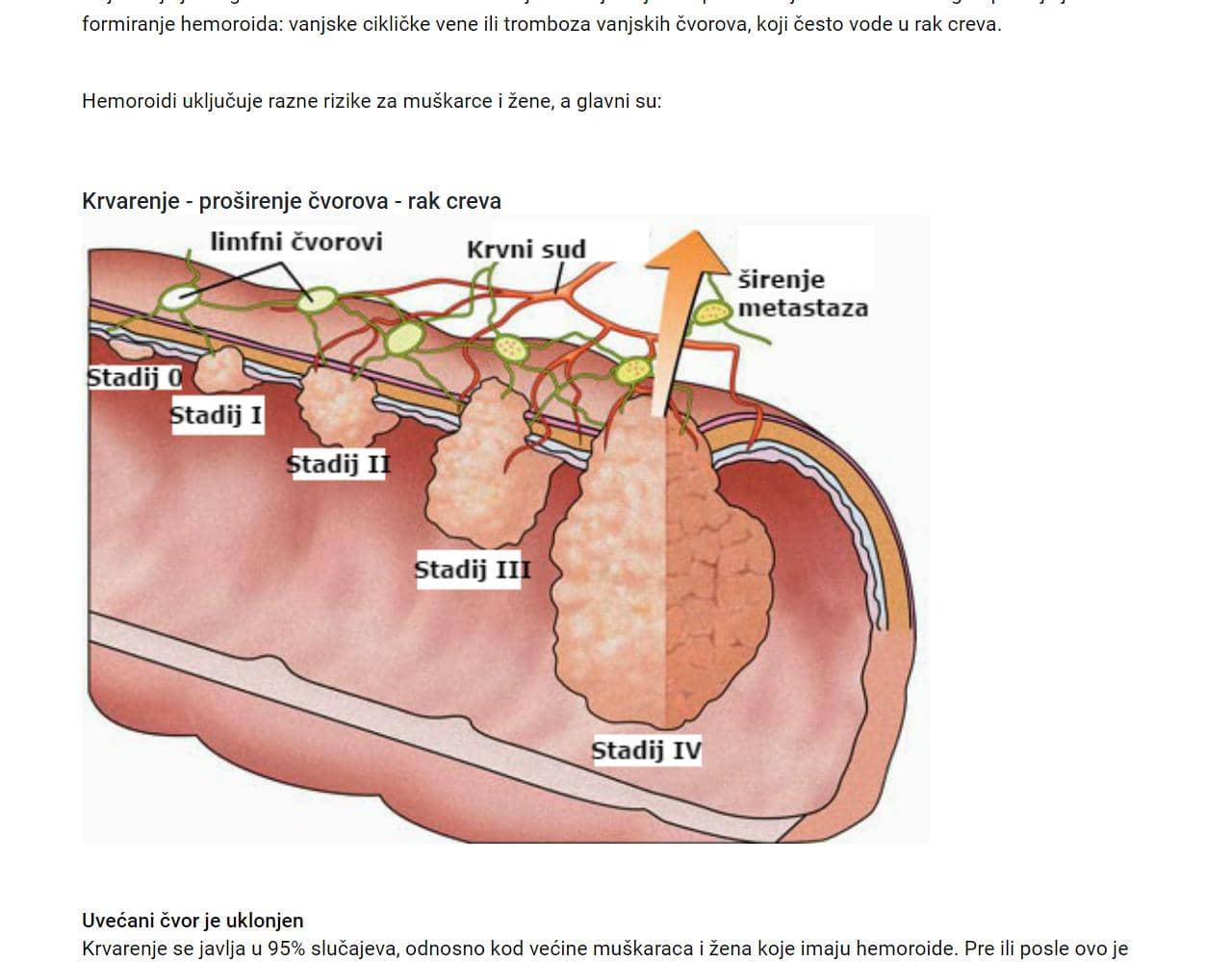 Hemoflex 2