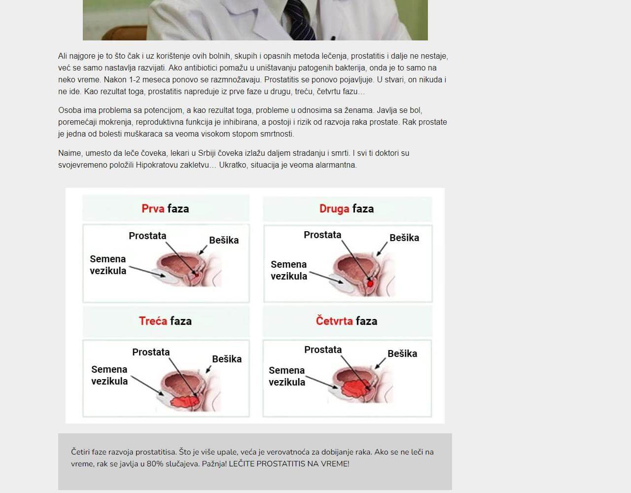 Prostatin 4